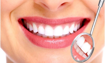 Bọc răng sứ giá bao nhiêu?